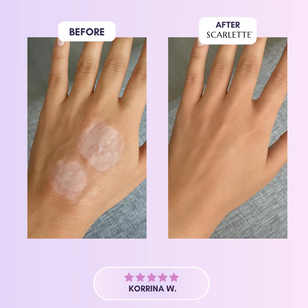 Scarlette™ Silicone Collagen Sheets